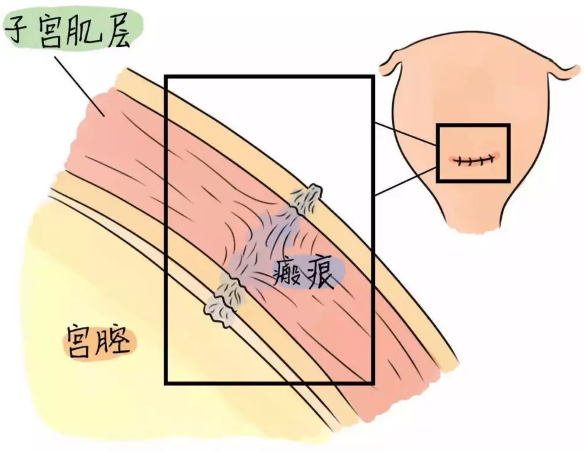 重慶送子鳥醫院