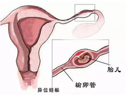 重慶送子鳥醫院